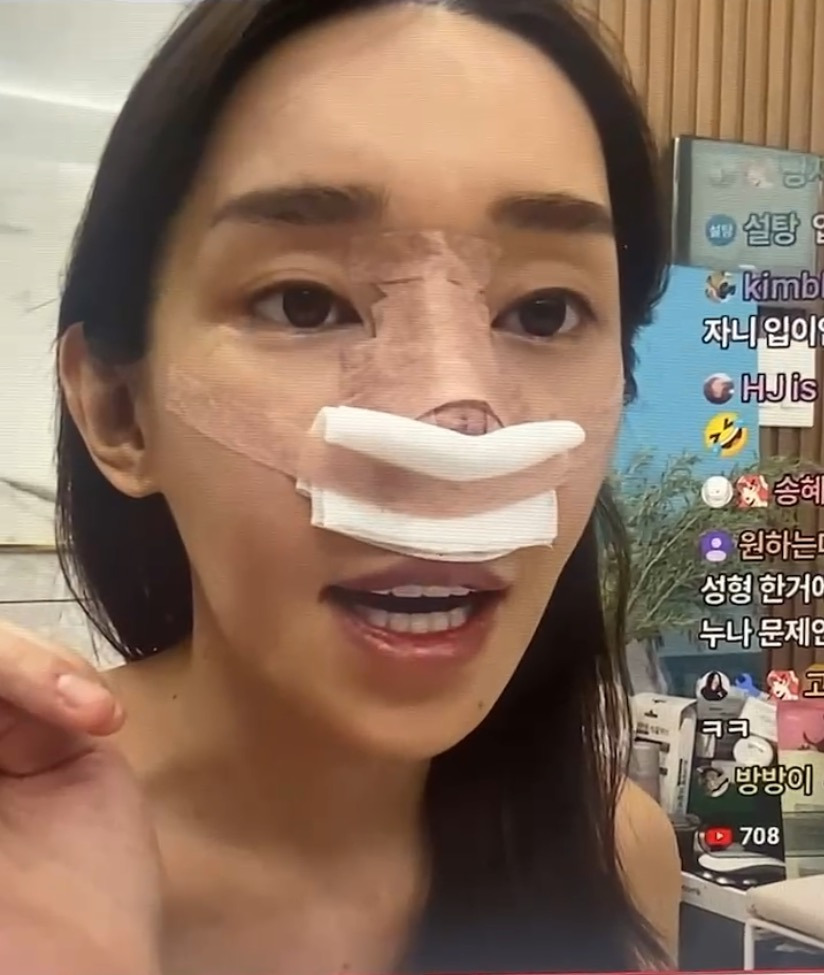 cUitjp.png